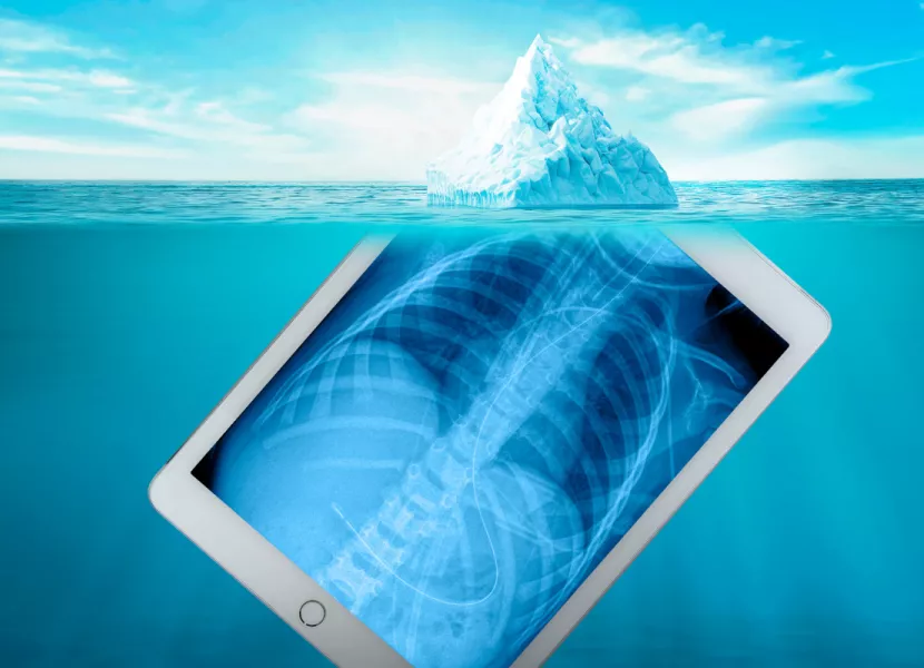 AGFA Radiology Solutions: une mise en image révélatrice